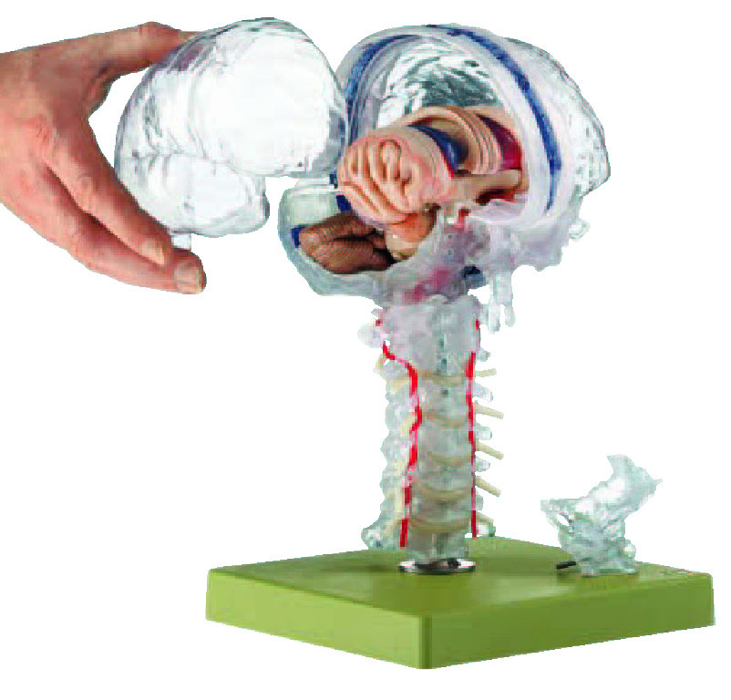 Somso® Transparent Brain Model