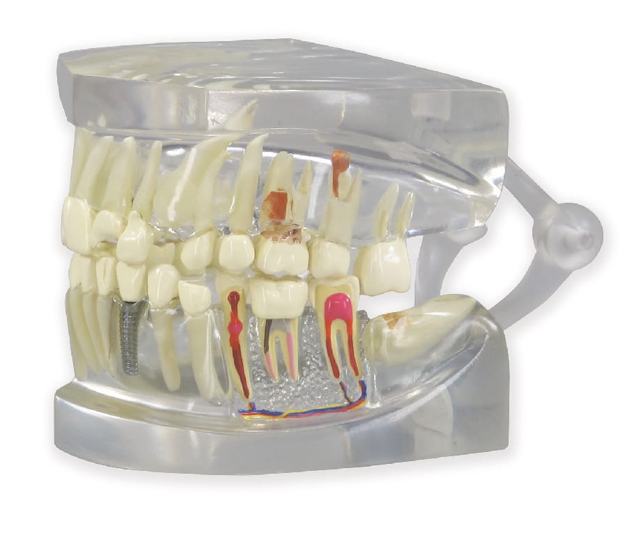 GPI Anatomicals® Clear Human Jaw with Teeth Model