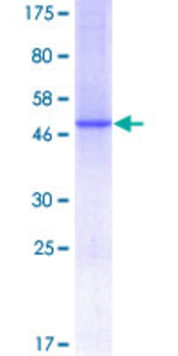 Human Recombinant C1QC (from Wheat germ) | VWR, part of Avantor