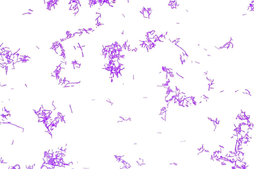Salmonella typhimurium Slide