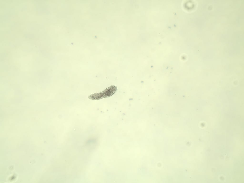 Schistosoma manson, Miracidia Slide