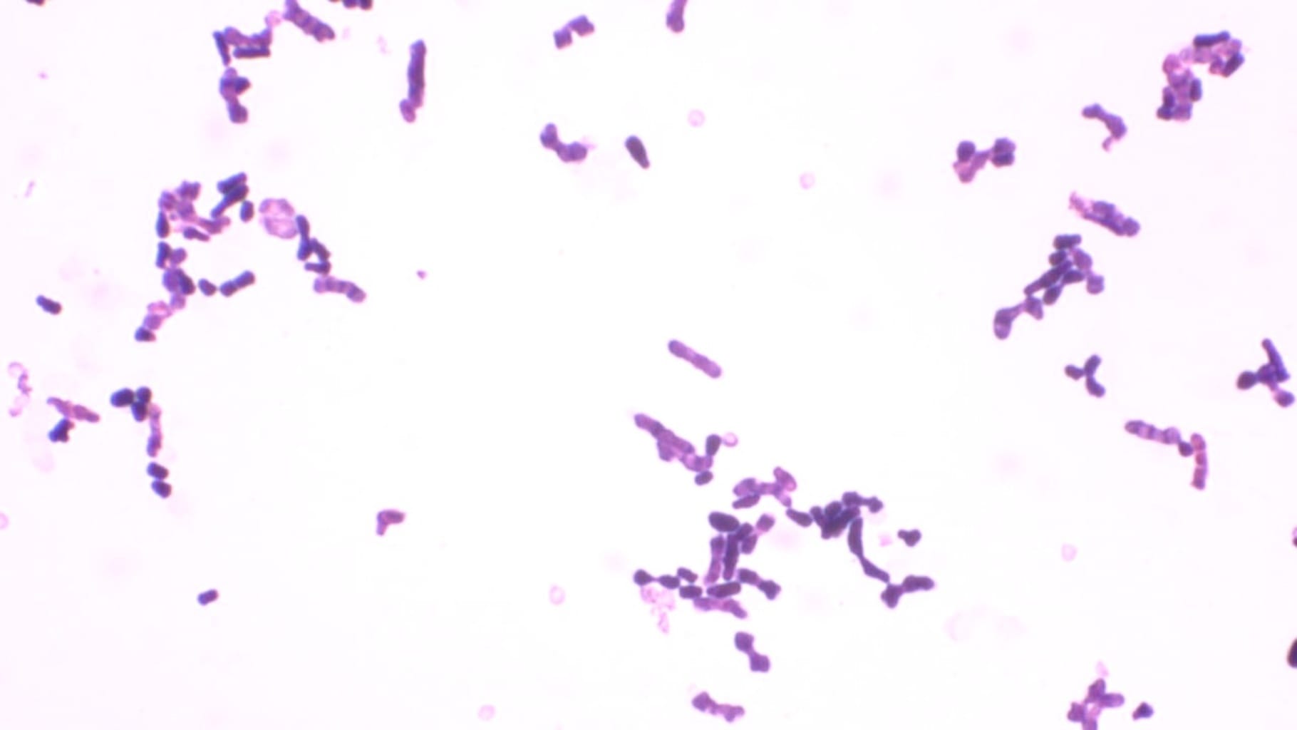 Saccharomyces, Sporulation Slide