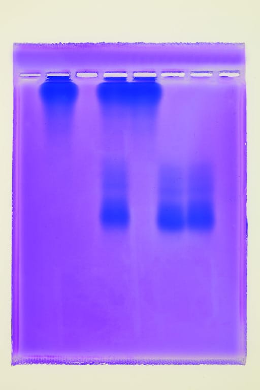 Ward's® Screening Hemoglobin for Sickle Cell Lab Activity