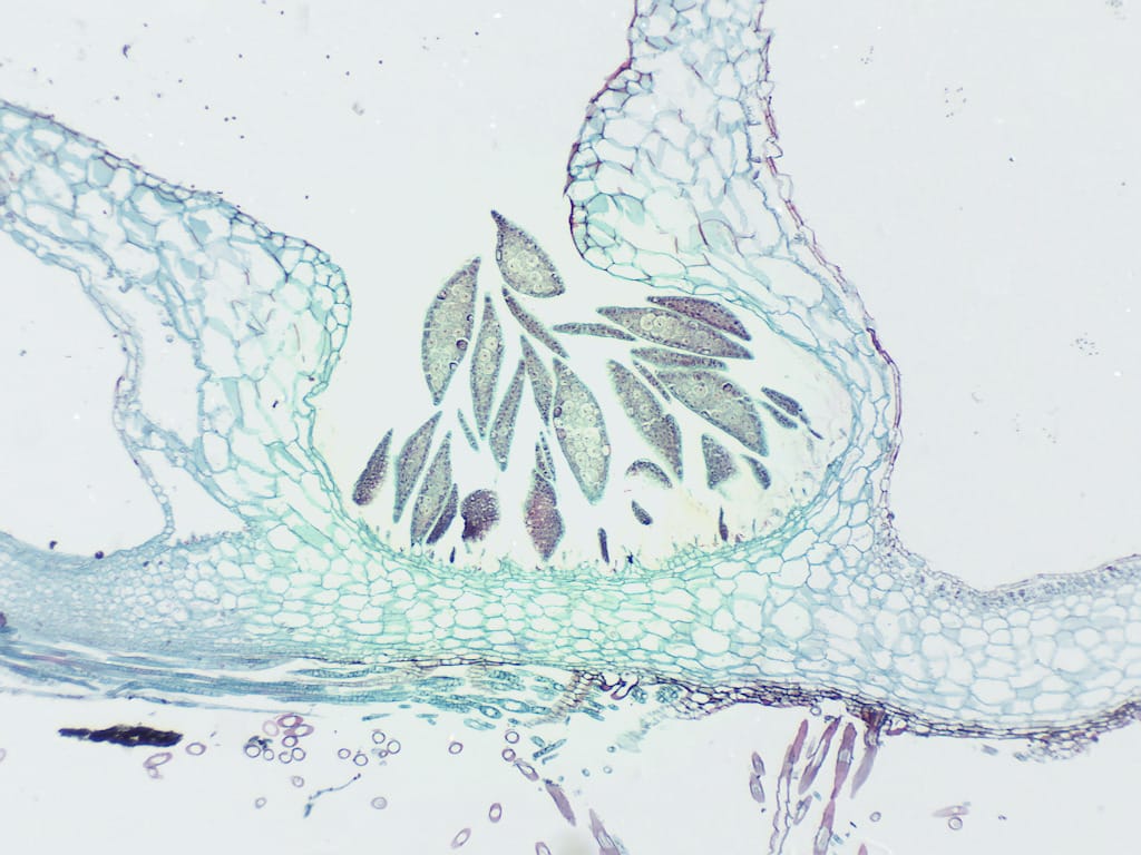 Ward's® Liverwort (Marchantia) Slides