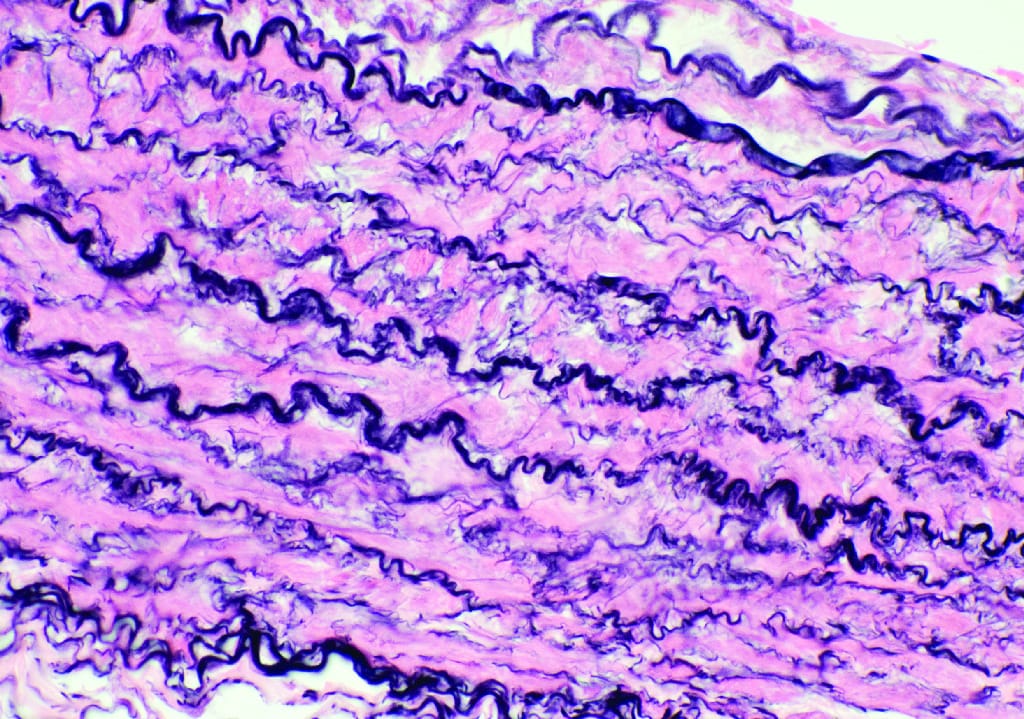 Artery Slide