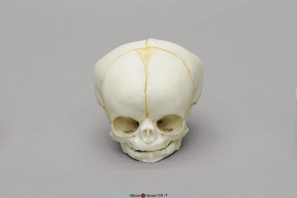 BoneClones® Fetal Skull Set