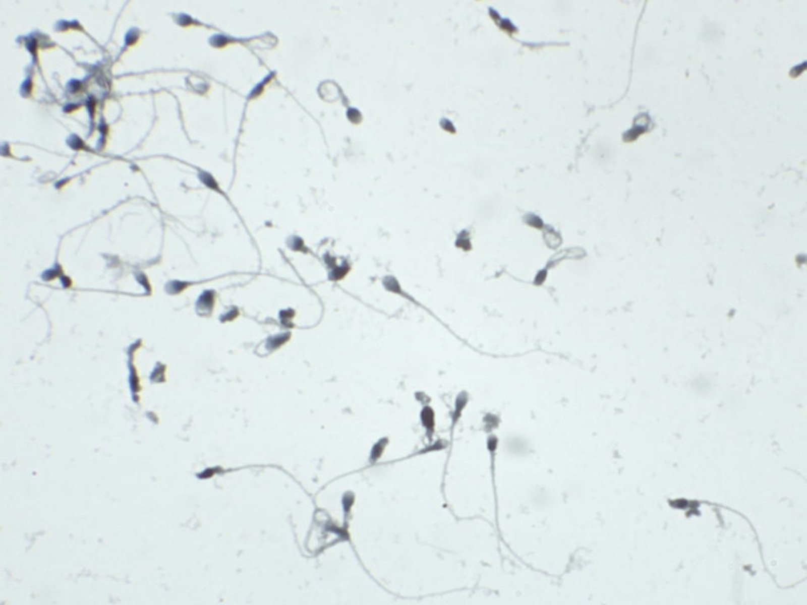 Human Sperm