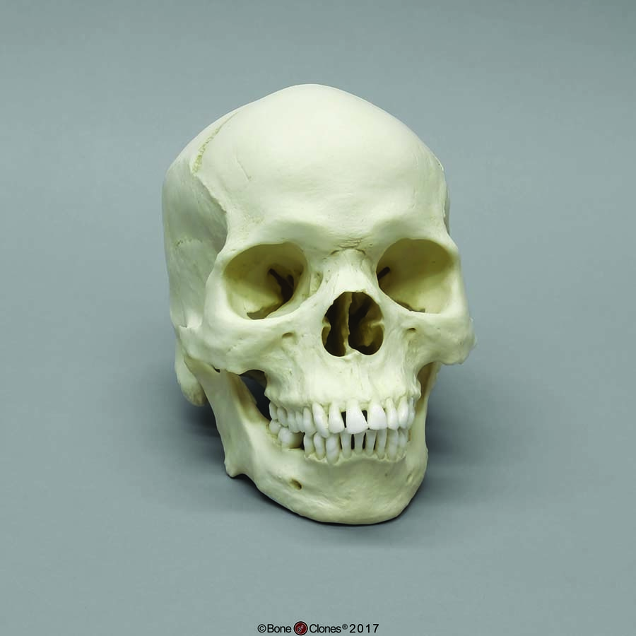 BoneClones® Regional Human Skulls