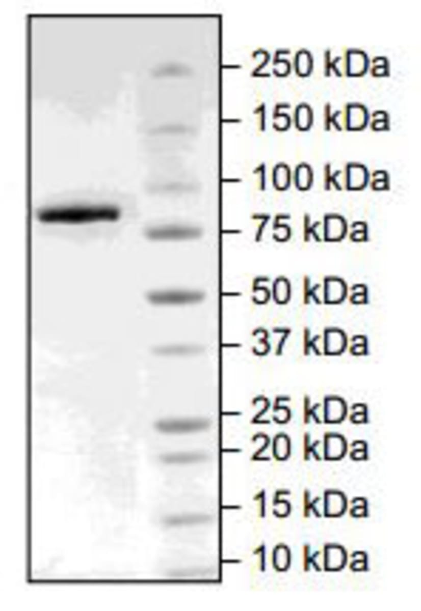 Human Recombinant Tankyrase 2/TNKS2 (from Baculovirus (Sf9 Insect cells ...