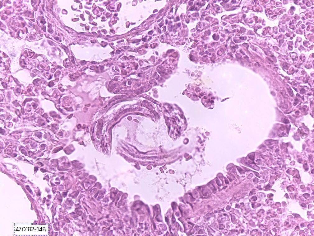 <i>Ascaris lumbricoides</i> Slide