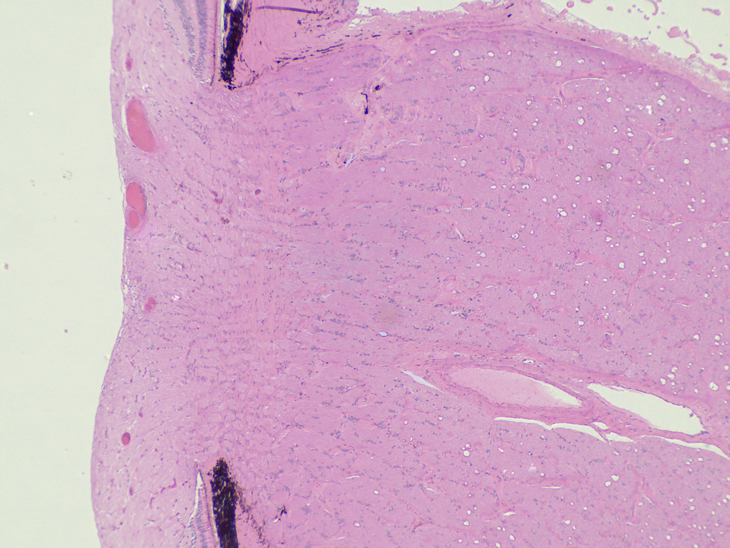 Eye, Optic Nerve Entrance Slide