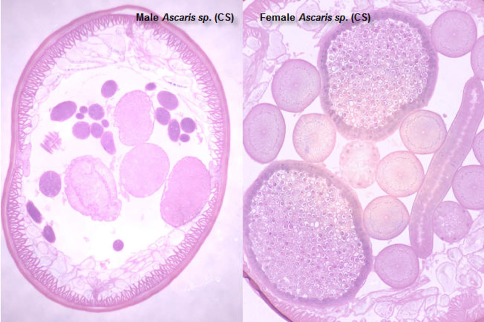 Ascaris lumbricoides Slide