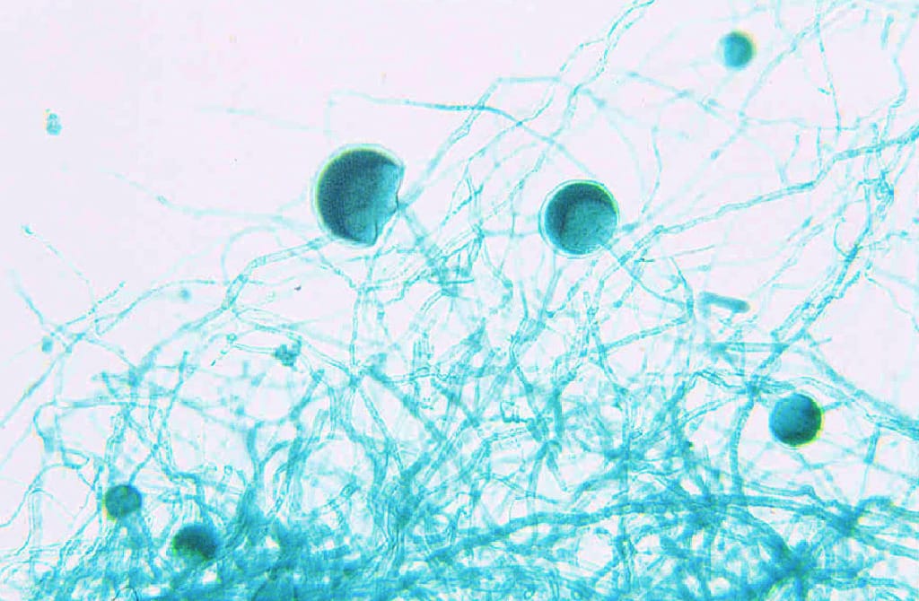 Rhizopus, Sporangia Slide