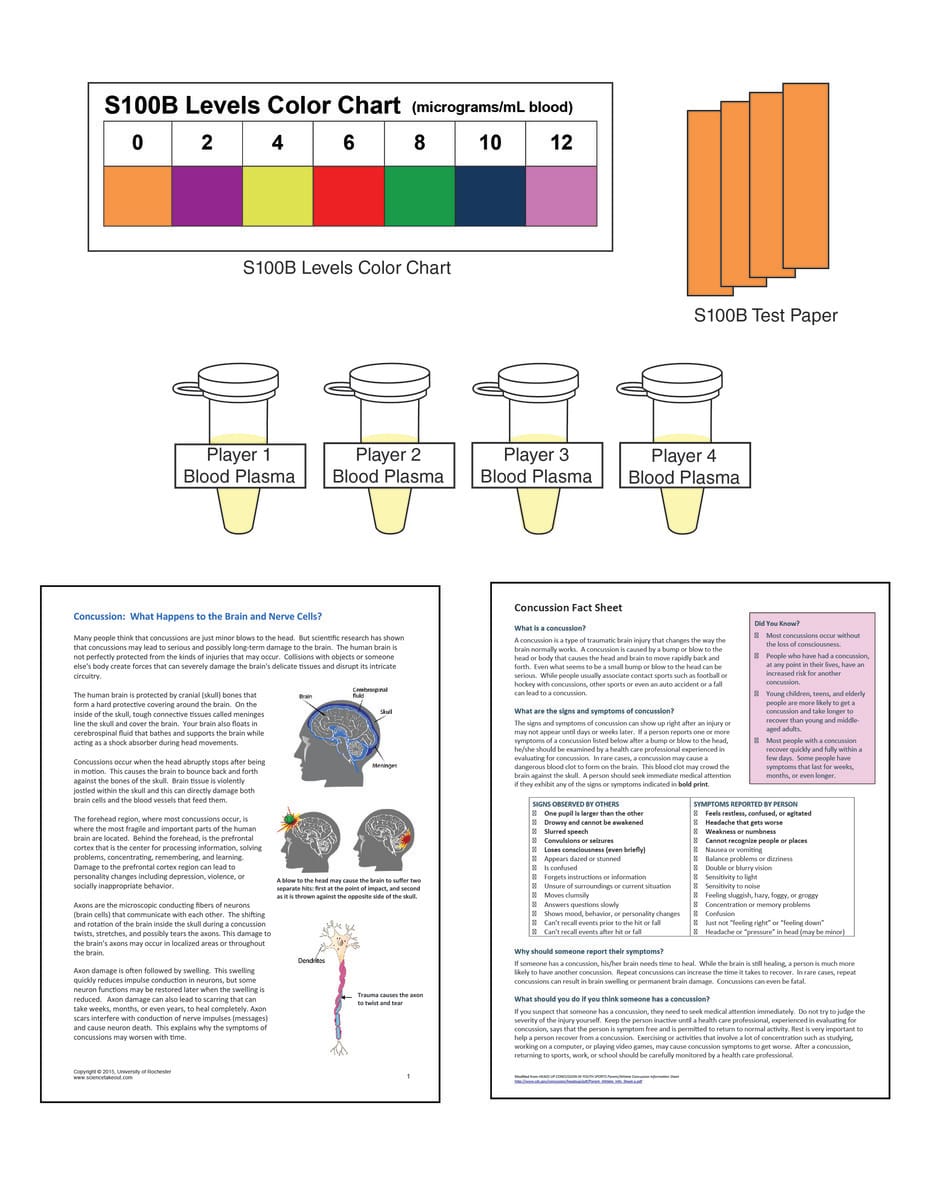 Science Take-Out® A Bang To The Head