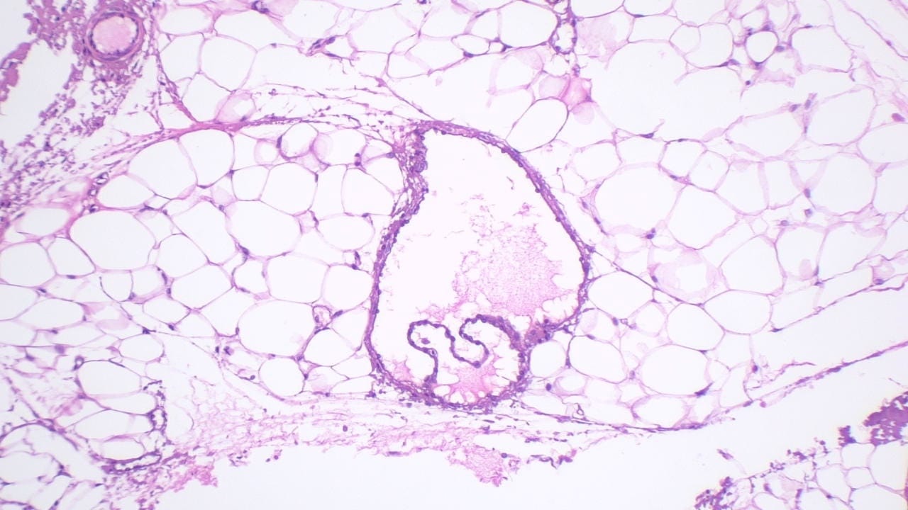 Lymphatic Vessel Slide