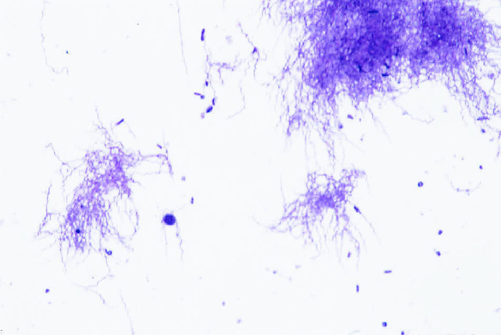 Borrelia burgdorferi Slide
