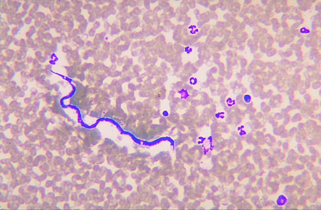 Dirofilaria immitis, Microfilariae Slide