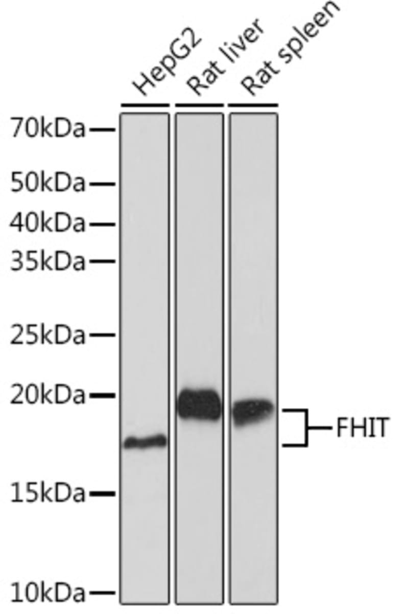 Anti-FHIT Rabbit Monoclonal Antibody [clone: ARC1401] | VWR, part of ...