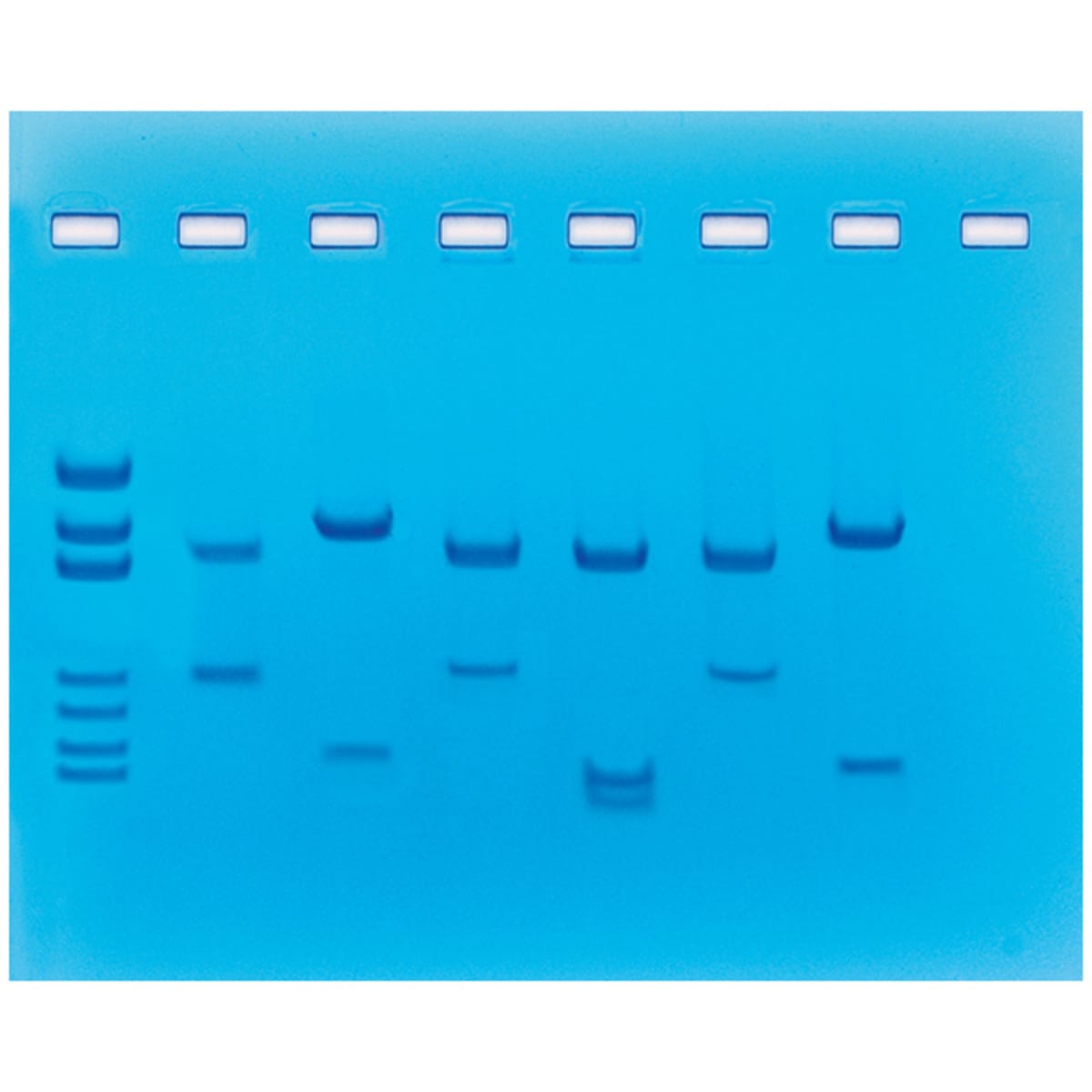 Usage of Restriction Enzymes in DNA Fingerprinting Analysis