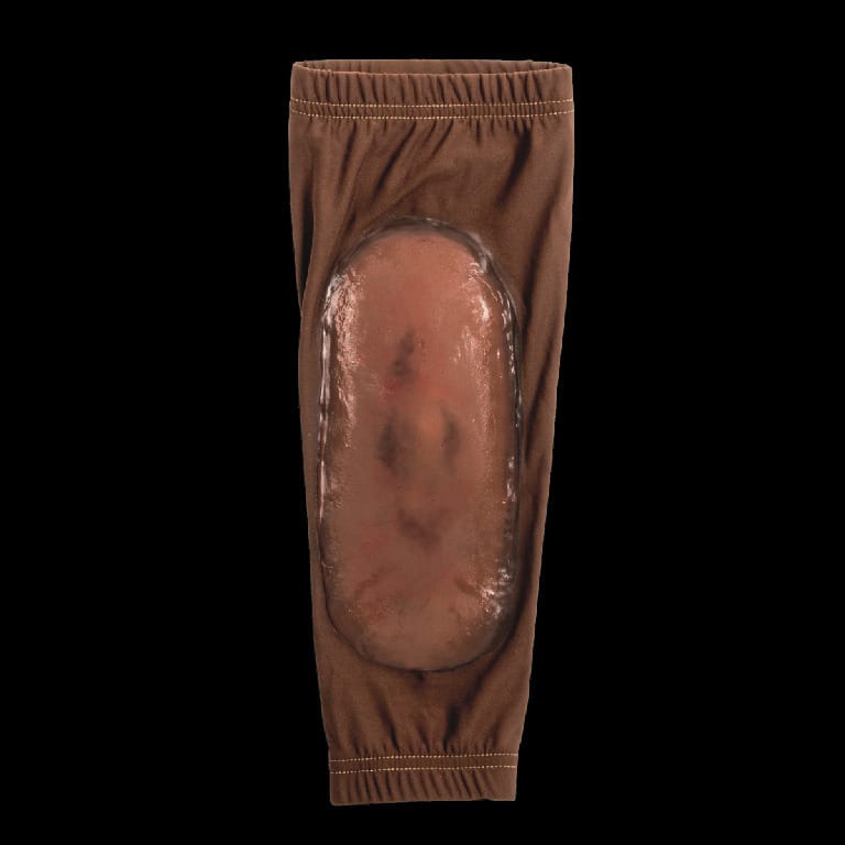 STOPS® Wound Clothing