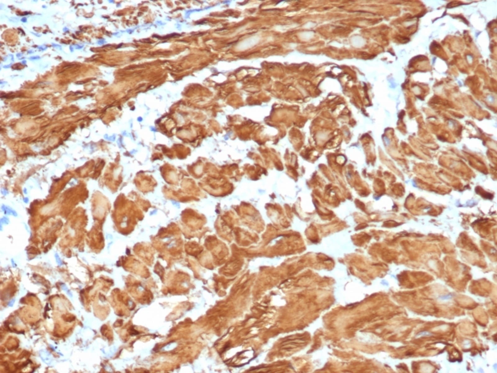 Anti-alpha Smooth Muscle Actin Rabbit Recombinant Antibody [clone ...