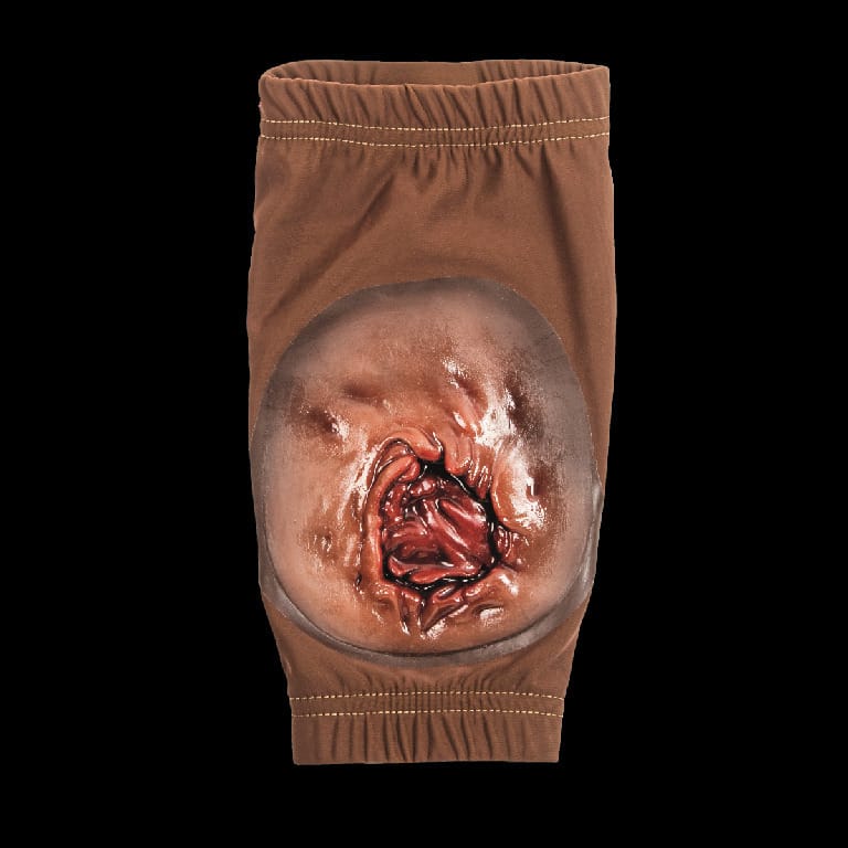 STOPS® Wound Clothing