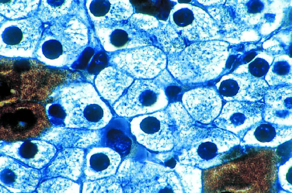 Mitochondria, Amphiuma Liver Slide