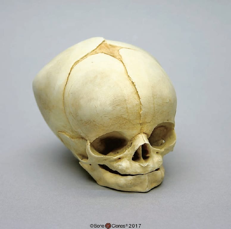BoneClones® Fetal Skull Set