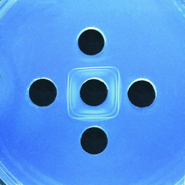 Antibody-Antigen Interaction Lab Activity