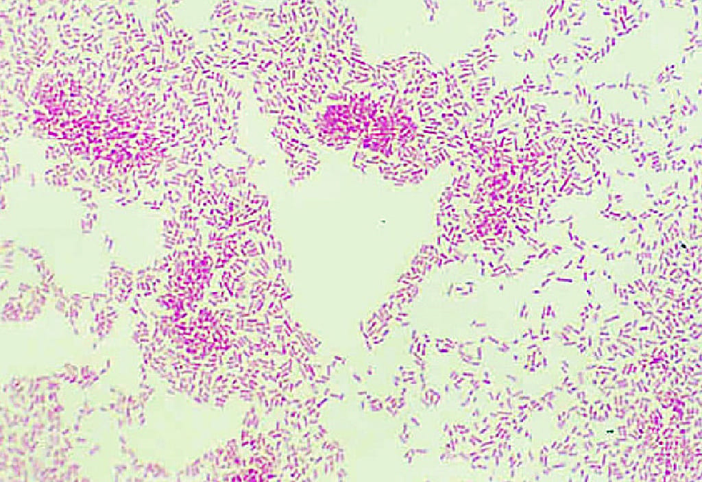 Ward's® Live Escherichia coli culture