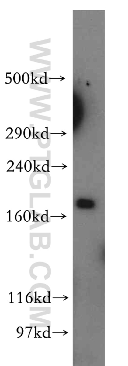 Anti-KALRN Rabbit Polyclonal Antibody | VWR, part of Avantor