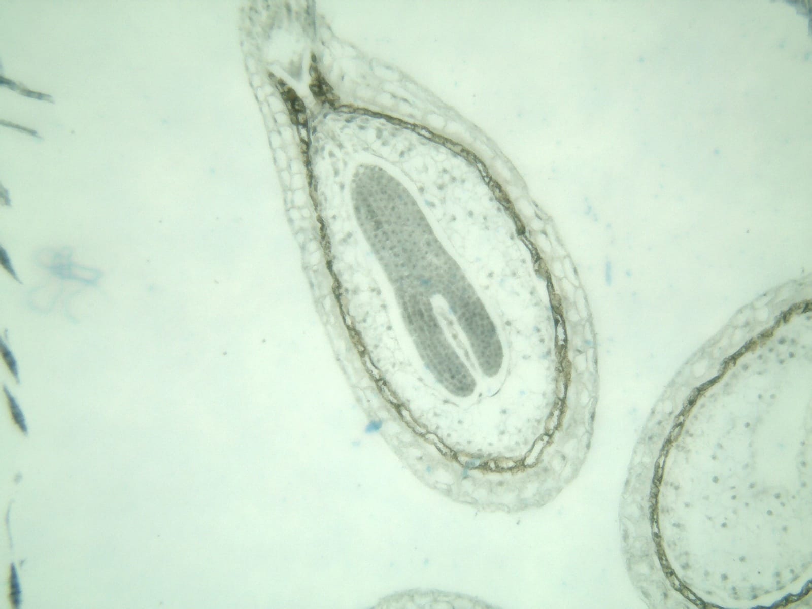 Early to Late Cotelydon Stage Demonstrating Torpedo-Shaped Embryo Slide