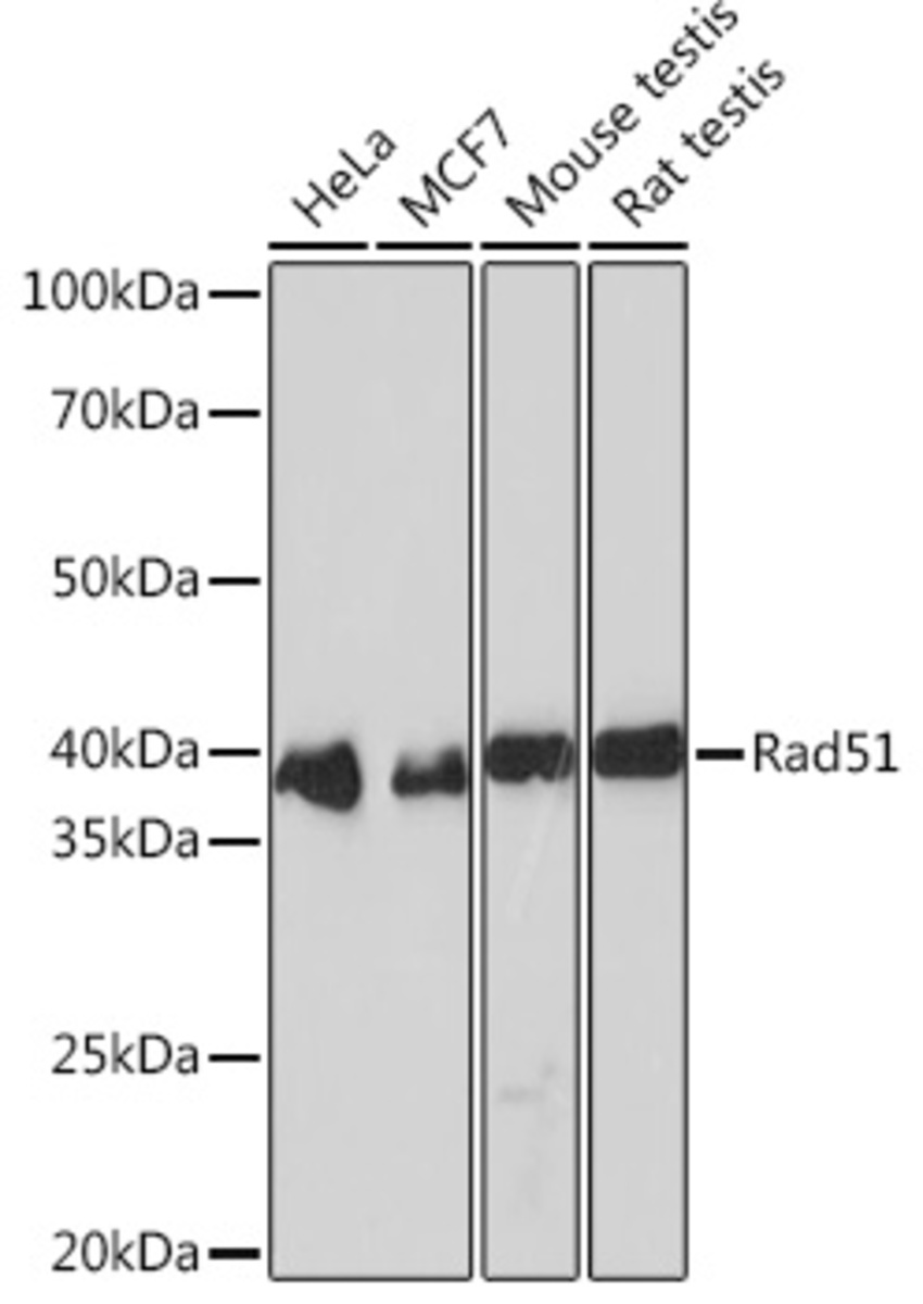 Anti-Rad51 Rabbit Monoclonal Antibody [clone: ARC0764] | VWR, part of ...