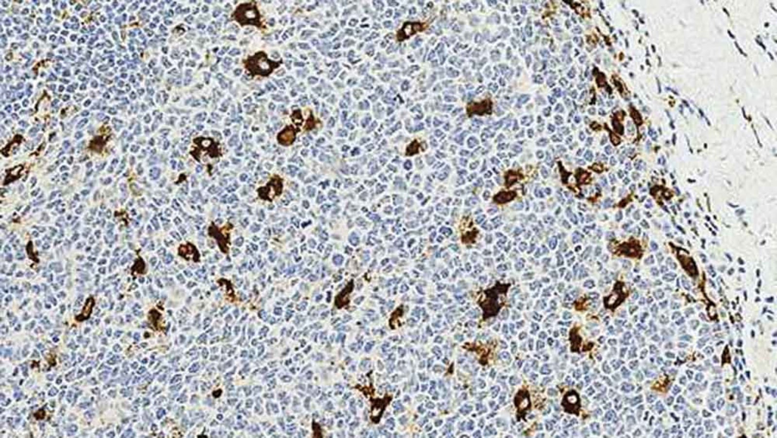 Anti-CD68 Mouse Monoclonal Antibody [clone: 514H12] | VWR, part of Avantor