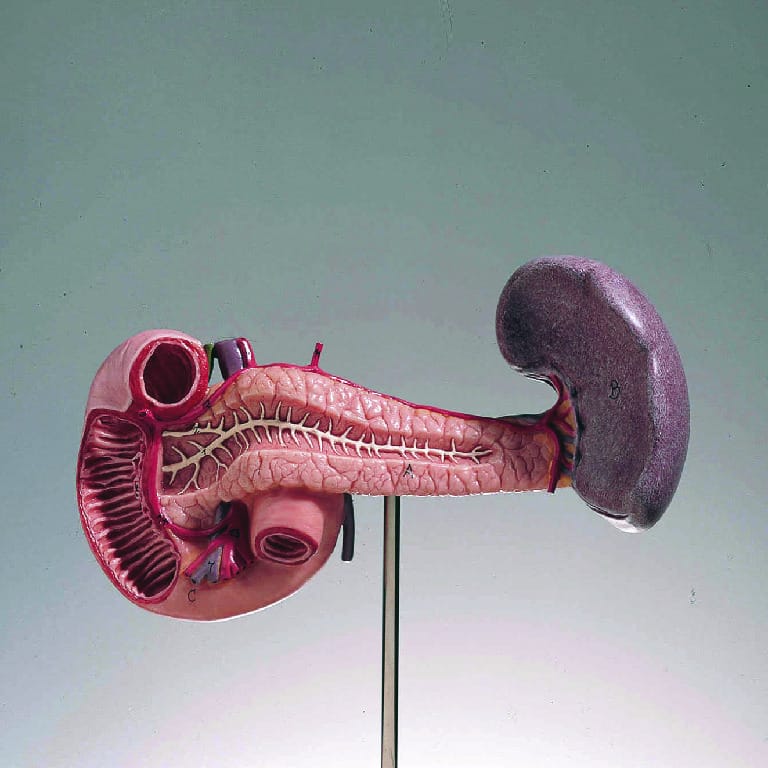 Somso® Pancreas, Spleen, and Duodenum Model