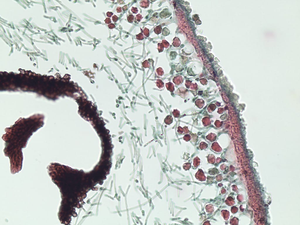 Ward's® Lichen Slides
