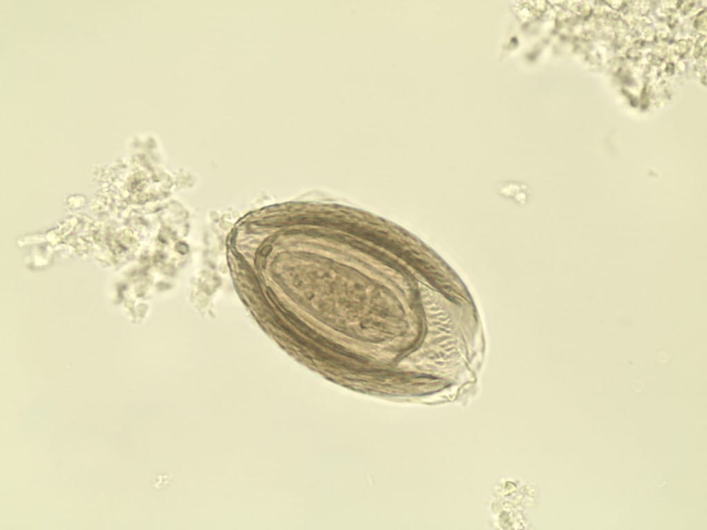 Acanthocephala, Eggs Slide