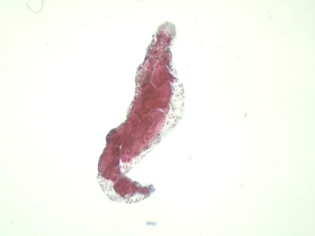 Fasciola hepatica, Redia Slide