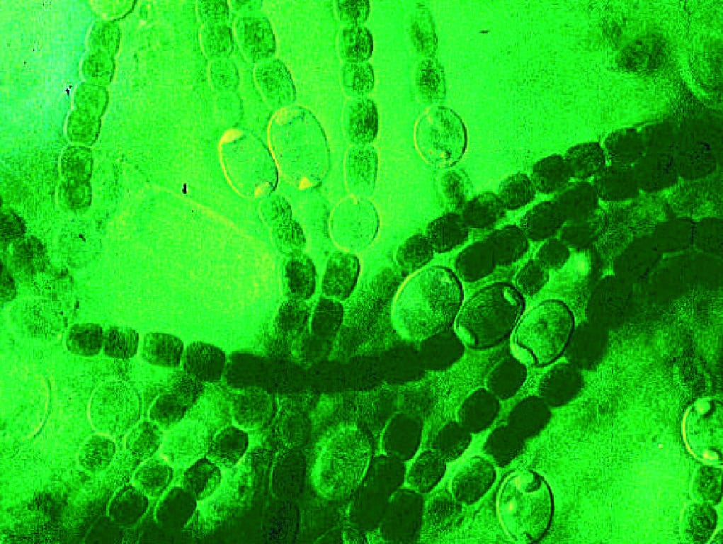 Ward's® Live Anabaena Culture