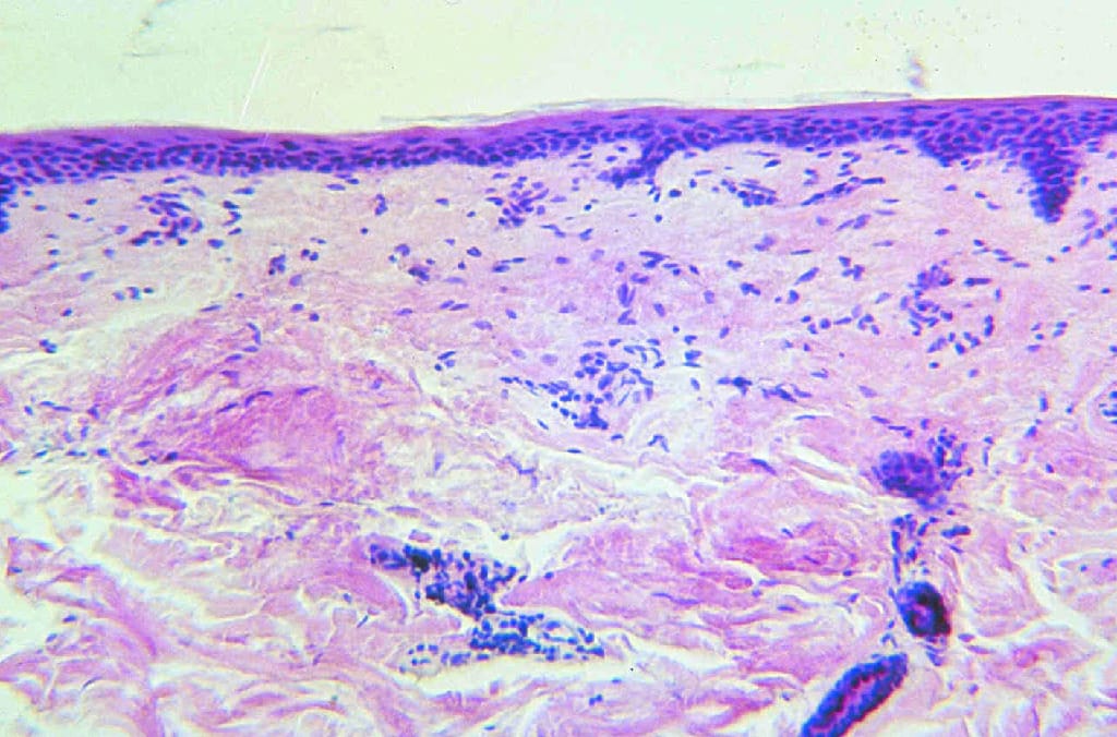Adult Skin, Unpigmented Slide