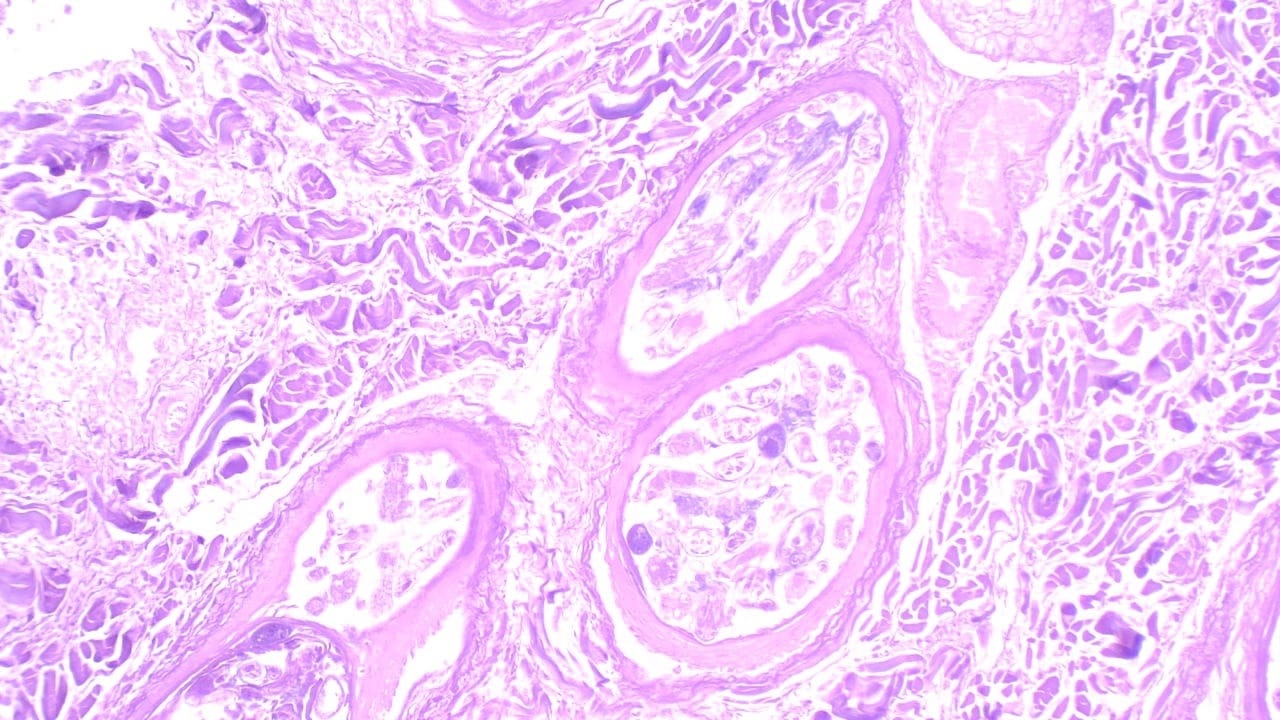 Demodex, In Situ Slide