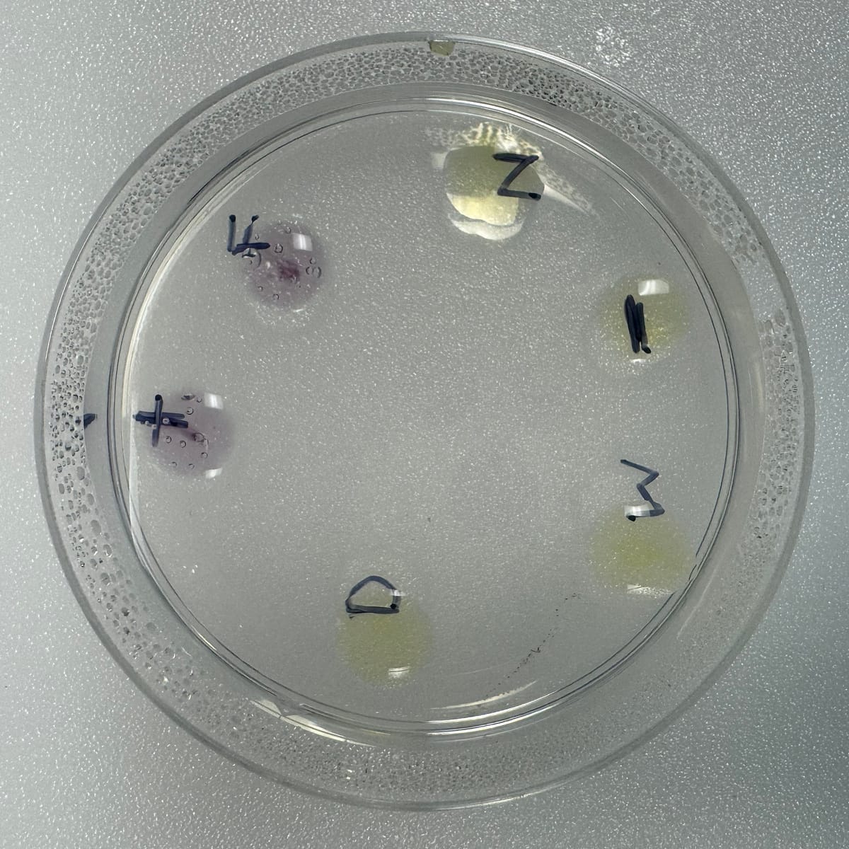 Edvotek® Immune Clues: Diagnosing Allergic Reactions