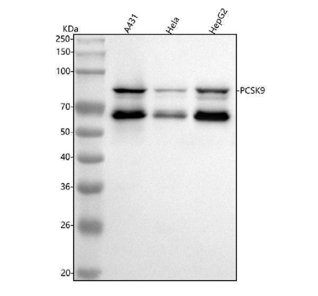 Anti-PCSK9 Rabbit Monoclonal Antibody [clone: ABFB-16] | VWR, part of ...