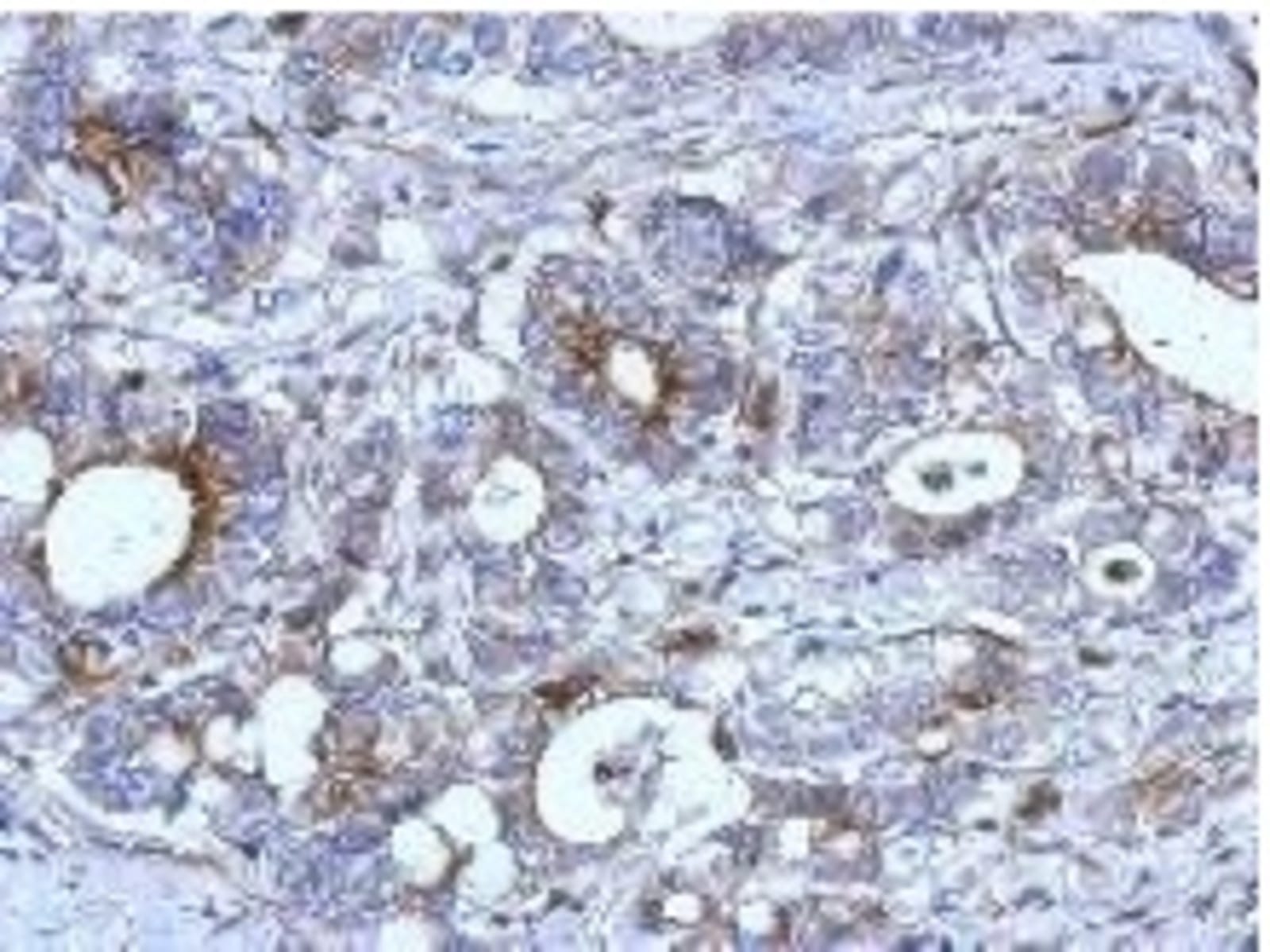 Anti-RAB33B Rabbit Polyclonal Antibody | VWR, part of Avantor