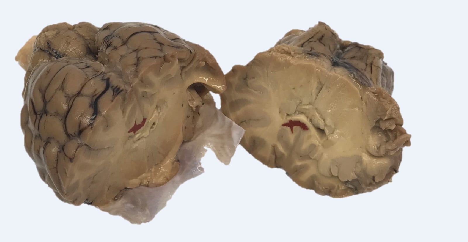 Ward's® Pure Preserved Sheep Brains with Simulated Strokes