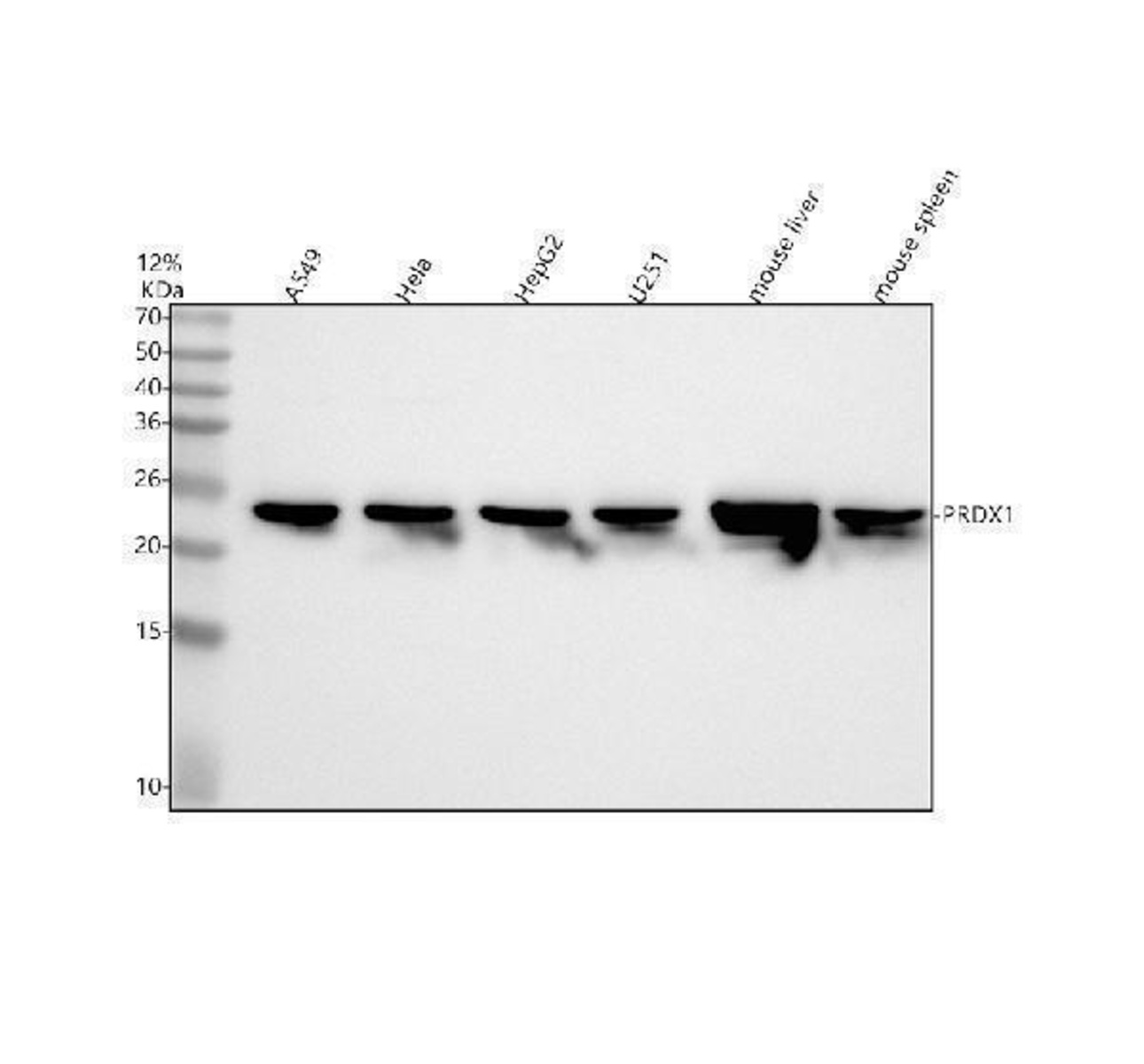 Anti-PRDX1 Rabbit Monoclonal Antibody [clone: IIG-16] | VWR, part of ...