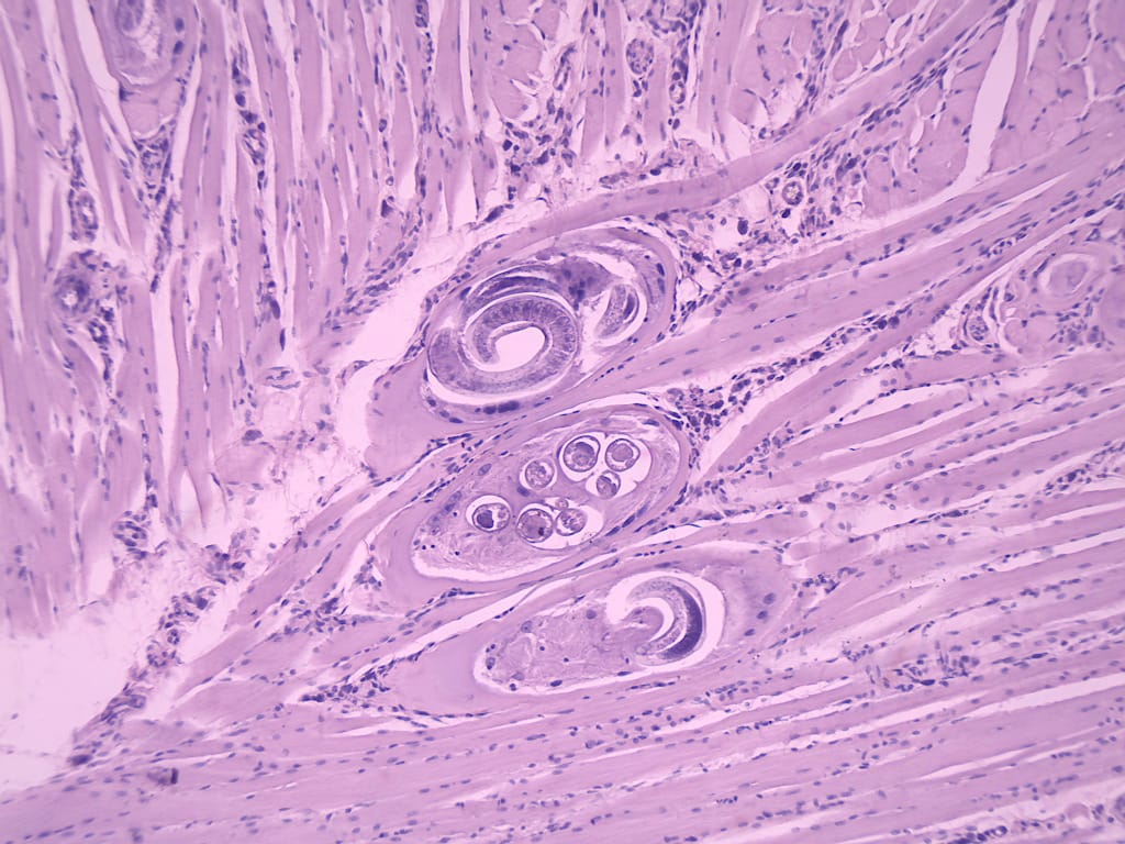 Trichinella spiralis, Encapsulated Larvae Slide
