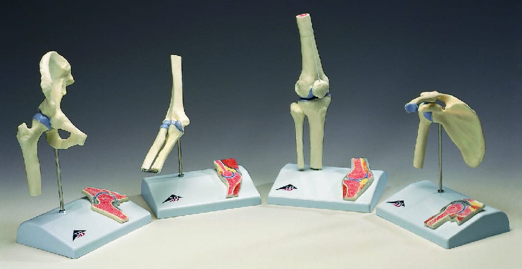 3B Scientific® Mini Joint with Cross-Section Model Set