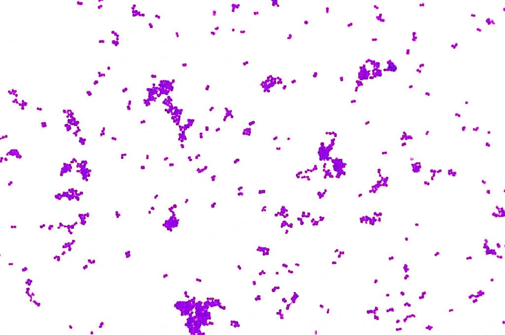 Neisseria gonorrheoeae Smear, Gram (-) Slides