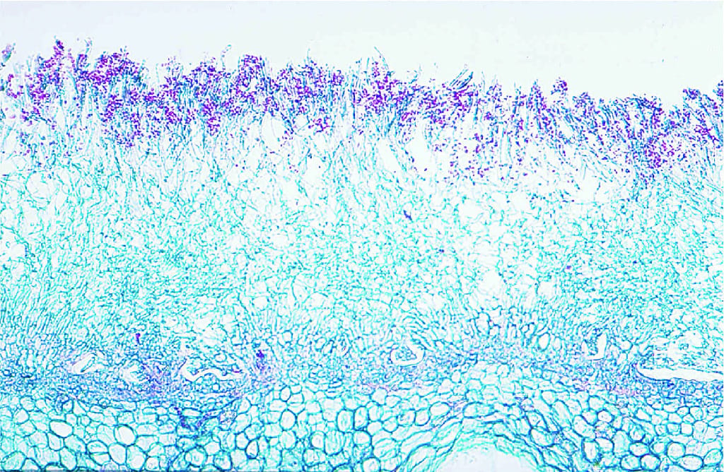 Penicillium Slide